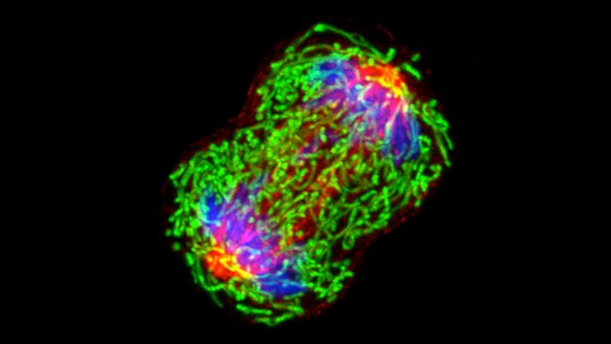 This microscopy image shows a breast cancer cell dividing into two. The components of the cell are shown in bright green, blue and red.